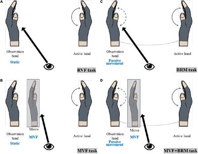 Synergistic Immediate Cortical Activation on Mirror Visual Feedback Combined With a Soft Robotic Bilateral Hand Rehabilitation System: A Functional Near Infrared Spectroscopy Study